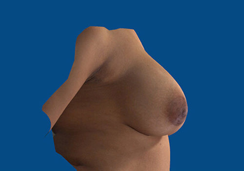 After Image