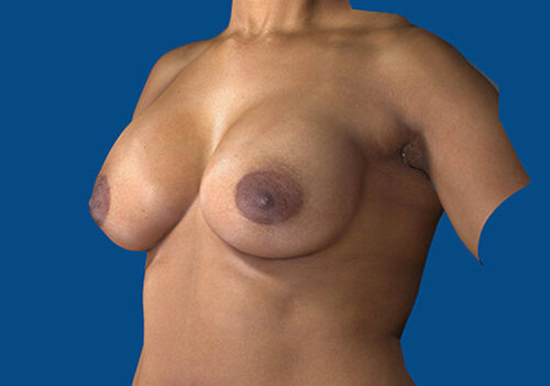 After Image
