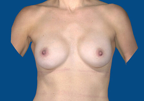 After Image