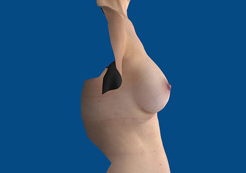 After Image