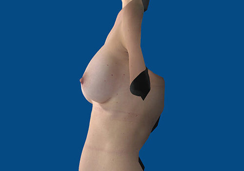 After Image