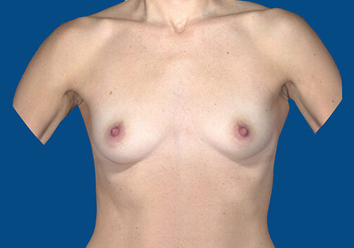 Before Image