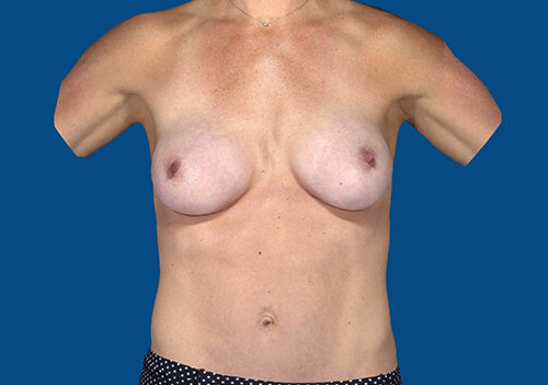 After Image