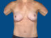 After Image