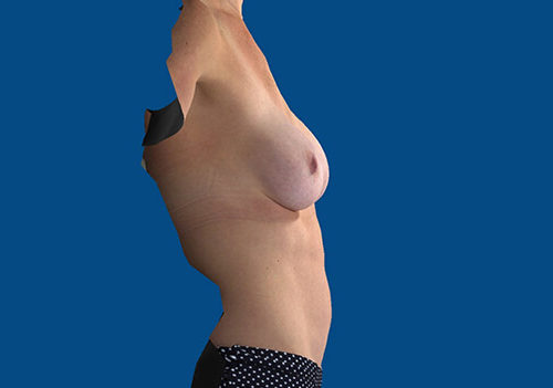 After Image