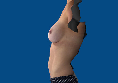 After Image