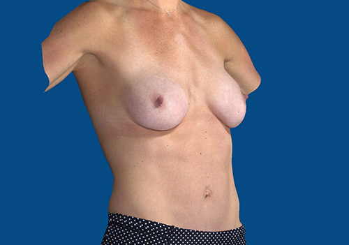 After Image