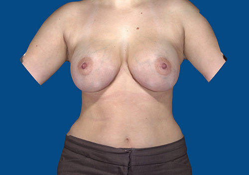 After Image