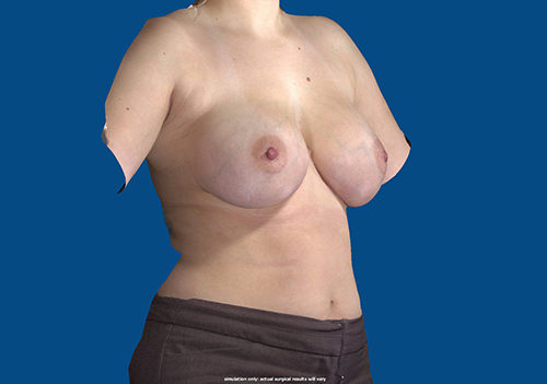 After Image