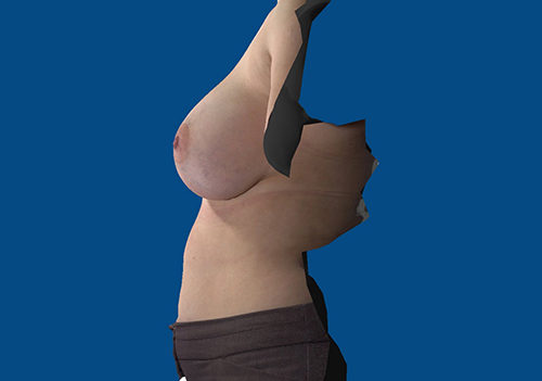 After Image