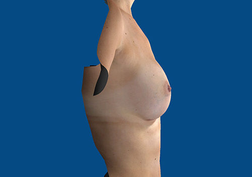 After Image