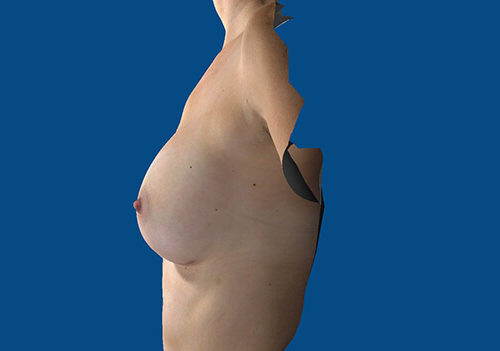 After Image