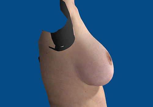 After Image