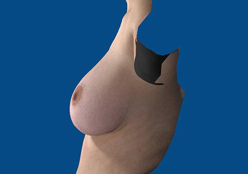 After Image