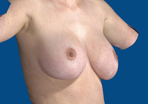 After Image