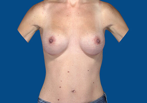 After Image