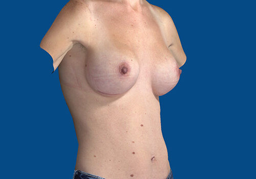 After Image