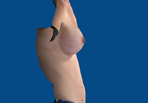 After Image