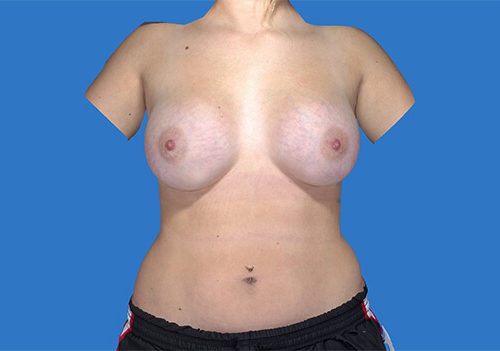 After Image