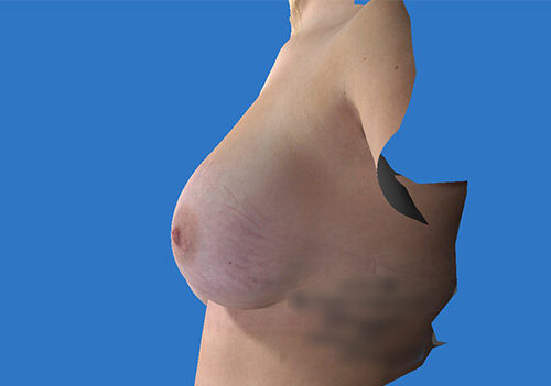After Image