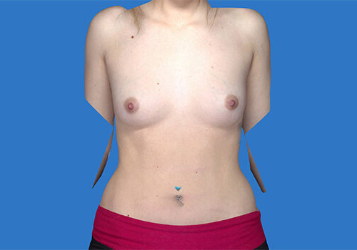 Before Image