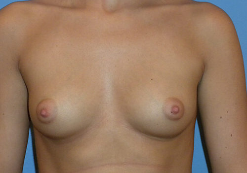 Before Image