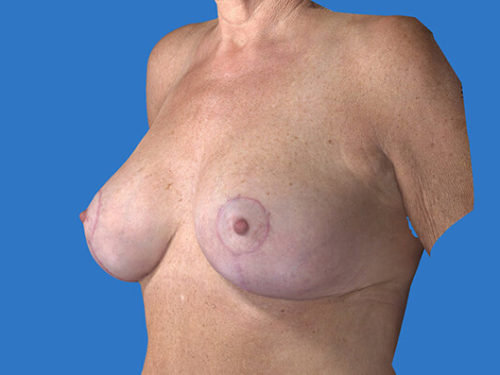 After Image