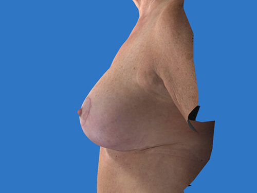 After Image