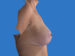 After Image