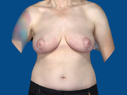 After Image