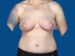 After Image