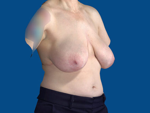 After Image