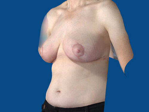 After Image