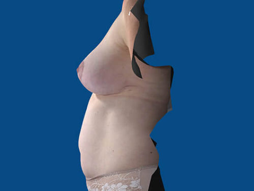 After Image