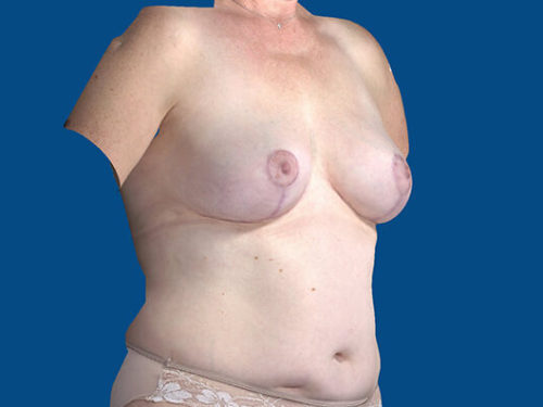 After Image