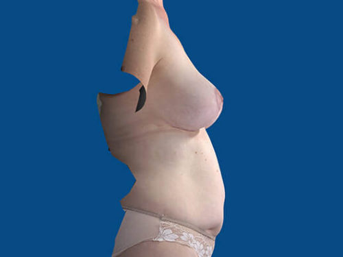 After Image