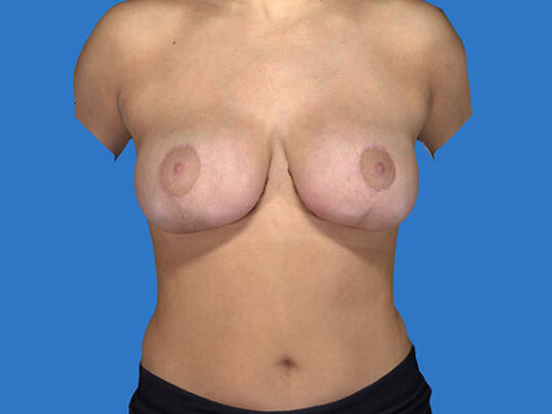 After Image