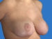 After Image
