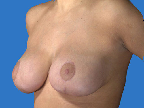 After Image