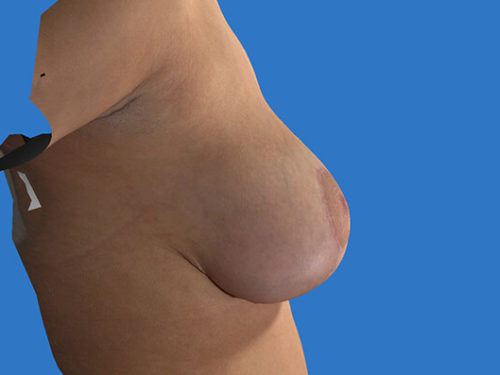 After Image