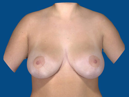 After Image