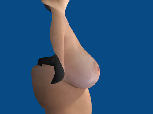 After Image