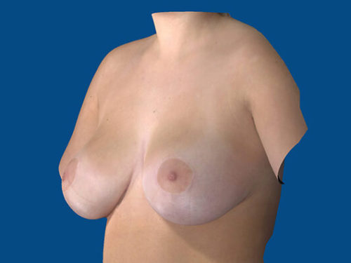 After Image