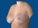 After Image