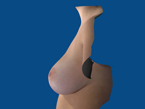 After Image