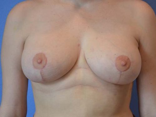 After Image