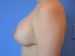 After Image