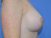 After Image