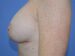 After Image