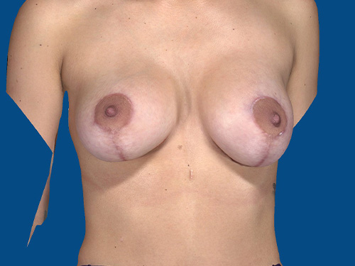 After Image